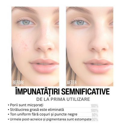 Ser Facial 7DAYS My Beauty Week B3 2% + ZN 0.5% Matifiant 20ml